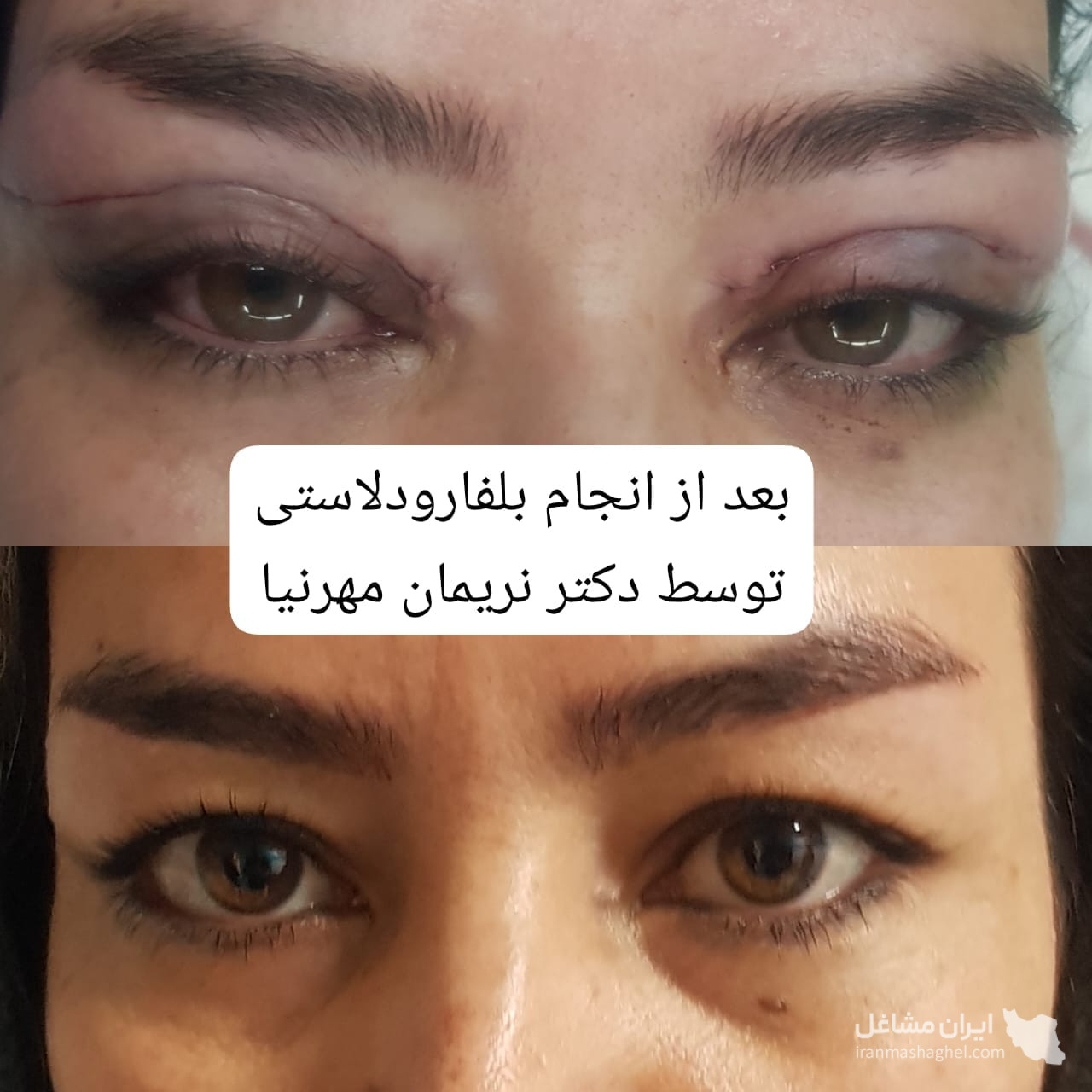مطب تخصصی پوست و مو دکتر نریمان مهرنیا در تهرانپارس تهران